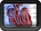 View Heart Disease (Coronary Artery Disease) Slideshow